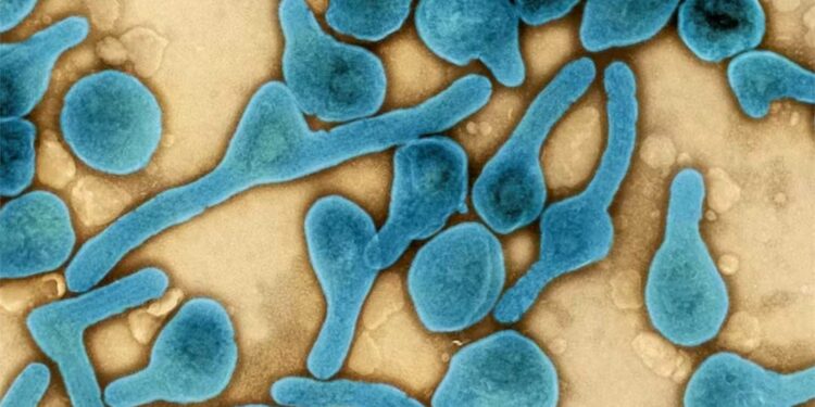 Equatorial Guinea: Laboratories Register Further Cases of Marburg Virus Disease