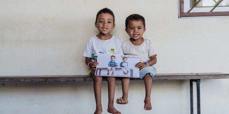 Medical Training in Madagascar Expands Treatment for Children With Clubfoot