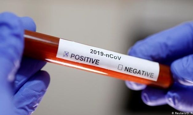 Egypt records 41 new coronavirus cases, 6 deaths
