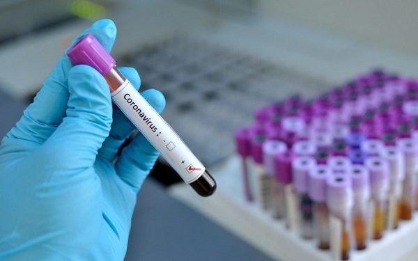 Ghana: 11 more covid-19 cases recorded, case count now 152