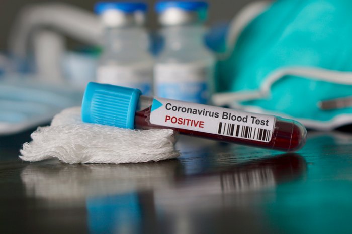 Zimbabwe Confirmed Coronavirus Cases Rise To Five – Health Ministry