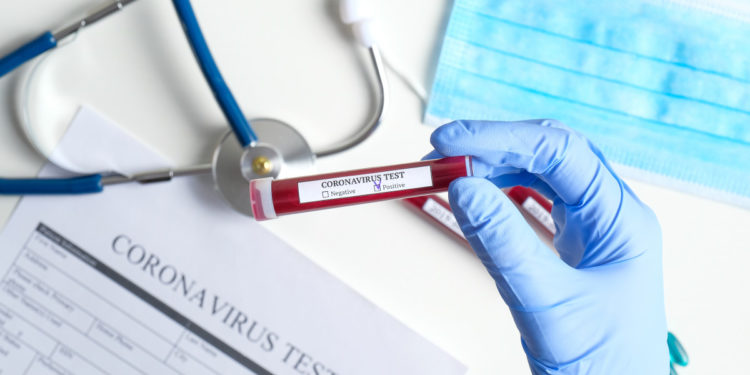 South Africa: number of Covid-19 cases rises to 4546