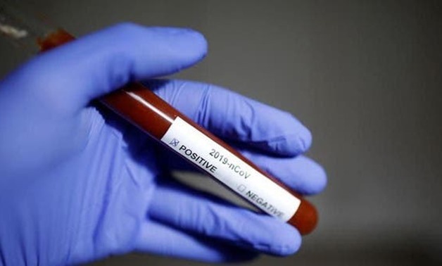 Egypt records 226 new coronavirus cases, 21 deaths