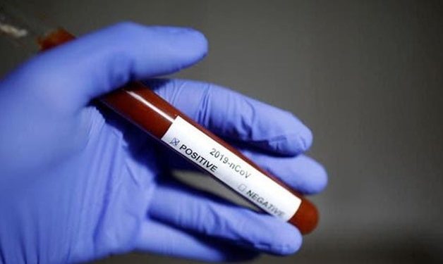 Egypt records 95 new coronavirus cases, raising total number to 1,794
