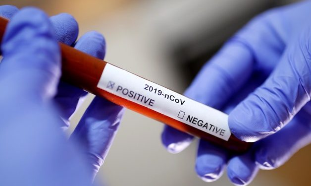 Egypt reports 110 new coronavirus cases, 9 deaths as gov't continues restrictions