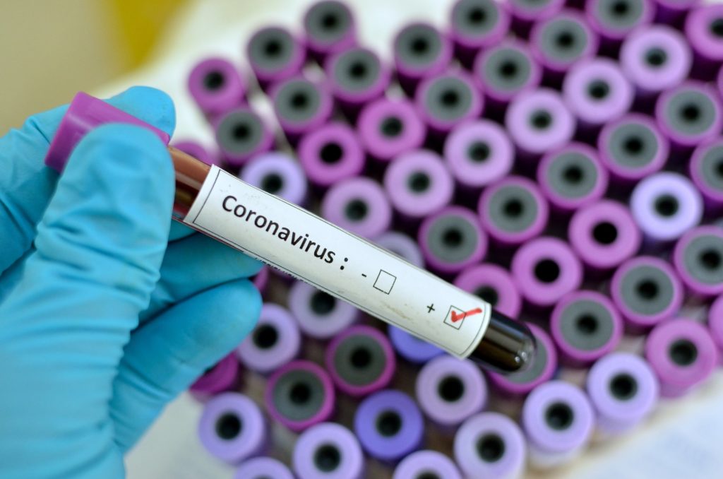 Coronavirus: Lagos Hospital warns visitors to isolate as staff tests positive