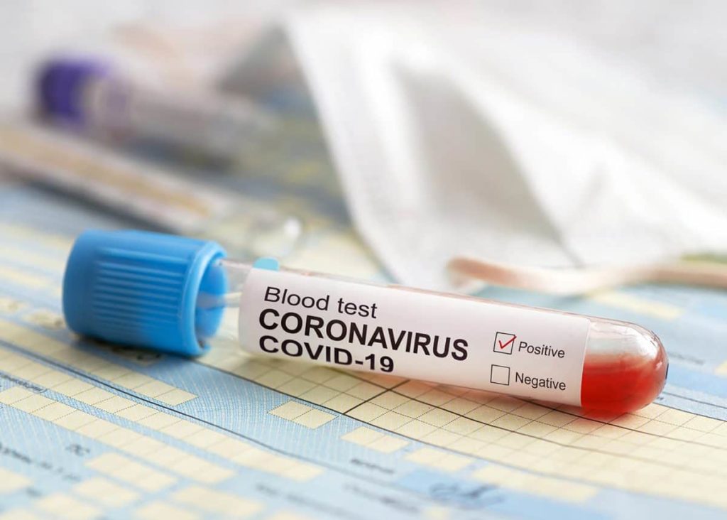 South Africa: Gauteng reports 350 coronavirus recoveries