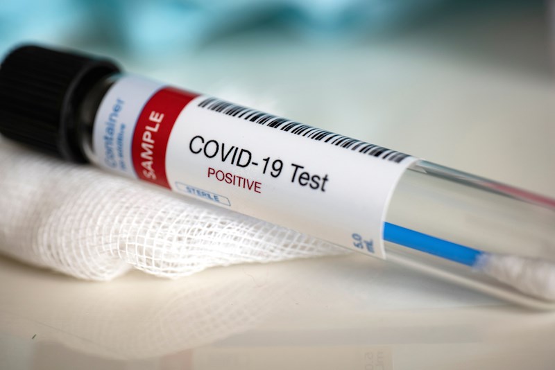 Uganda's virus cases rise to 45 as 301 test negative