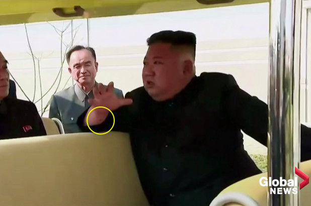 North Korea: Kim Jong Un resurfaces on state media with mysterious mark on wrist