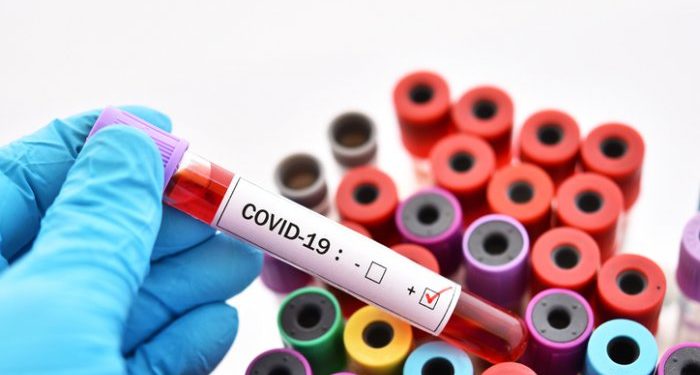 COVID 19: Positive cases in Equatorial Guinea rise to 960, Madagascar gets 405