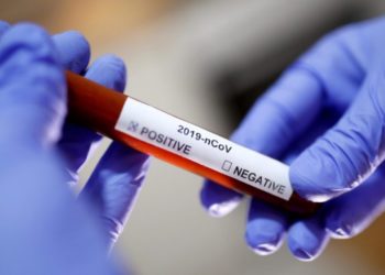 Kigali: Health survey shows no community transmission of COVID-19 in Rwanda