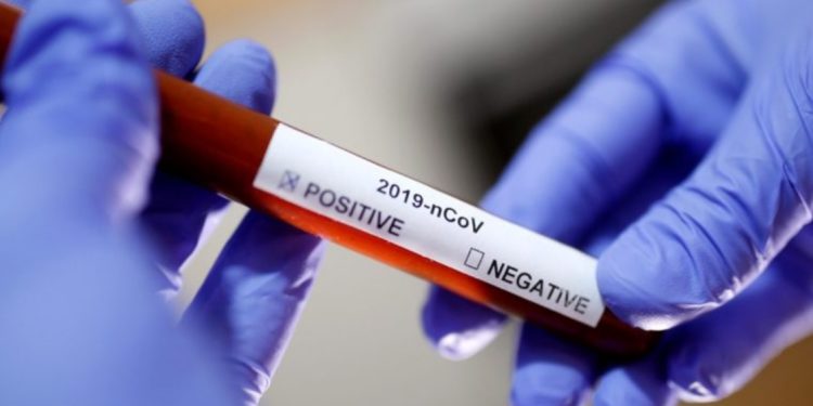 Kigali: Health survey shows no community transmission of COVID-19 in Rwanda