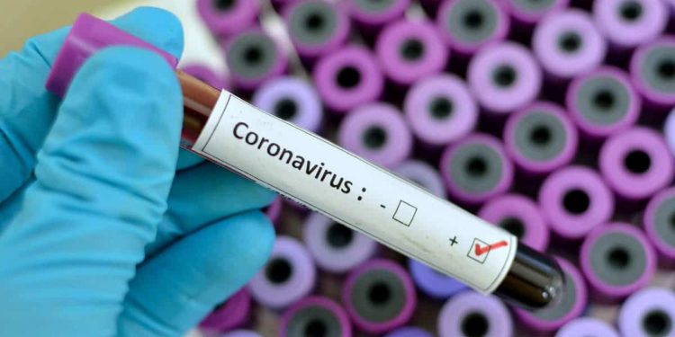 NCDC reports 645 new COVID-19 cases in Abuja, 19 States