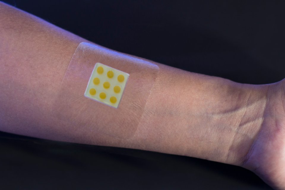 Tech: Smart plaster that tracks status of infections in wounds