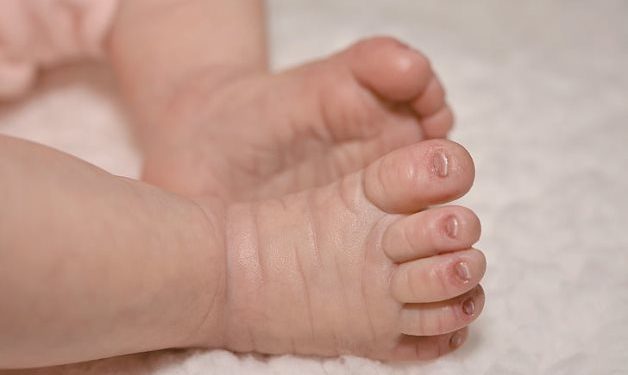 One-day-old baby undergoes successful cardiac catheterization in Egypt’s Port Said