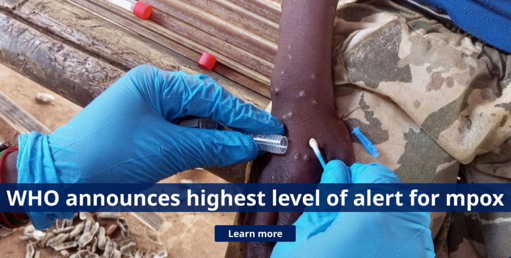 WHO Declares Mpox Outbreak in Africa a Public Health Emergency of International Concern